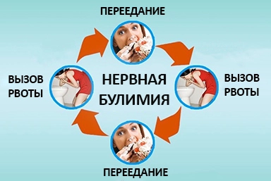 Лечение булимии в Сурхахи
